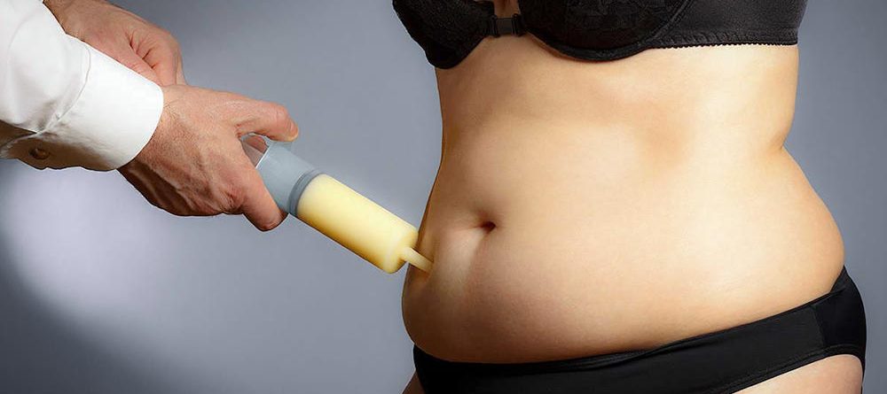 Liposuction in Turkey